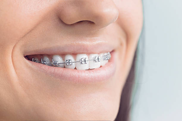 Best Dental Inlays and Onlays  in Lincolnwood, IL